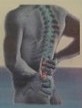 Spinal Pain