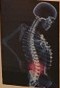 Back Pain